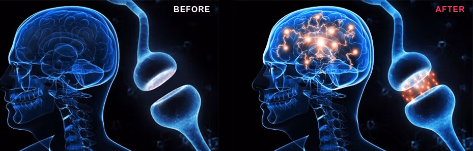 your brain on genbrain